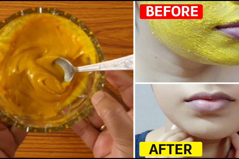 23 Selfmade Besan Face Packs For All Pores and pores and skin Varieties