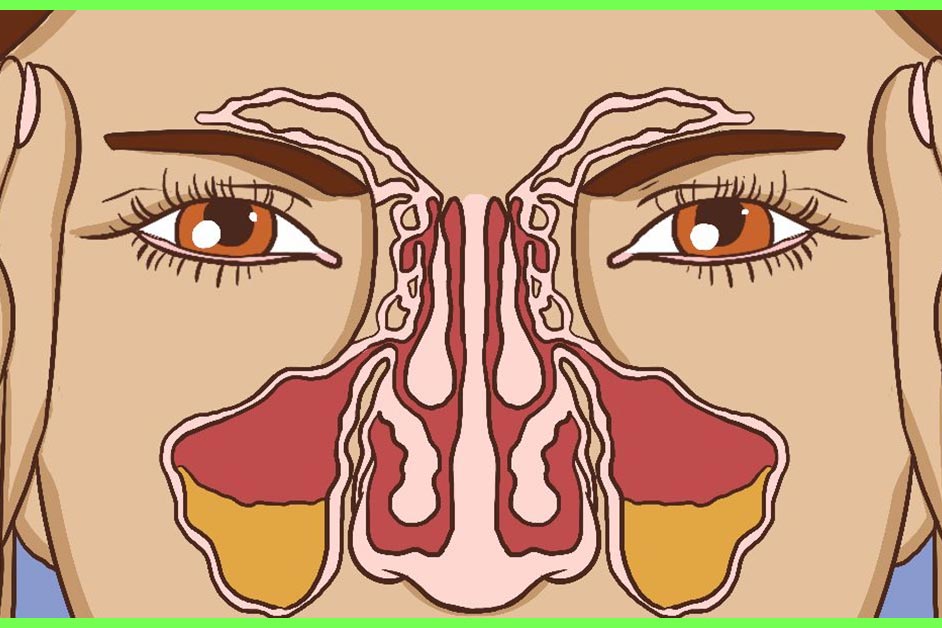 7 Finest Yoga Poses For Sinusitis – How To Do At Dwelling