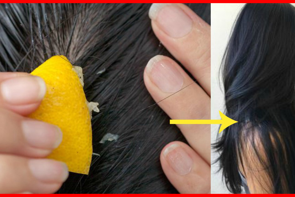 7 Methods In Which Lemon Helps Hair Development